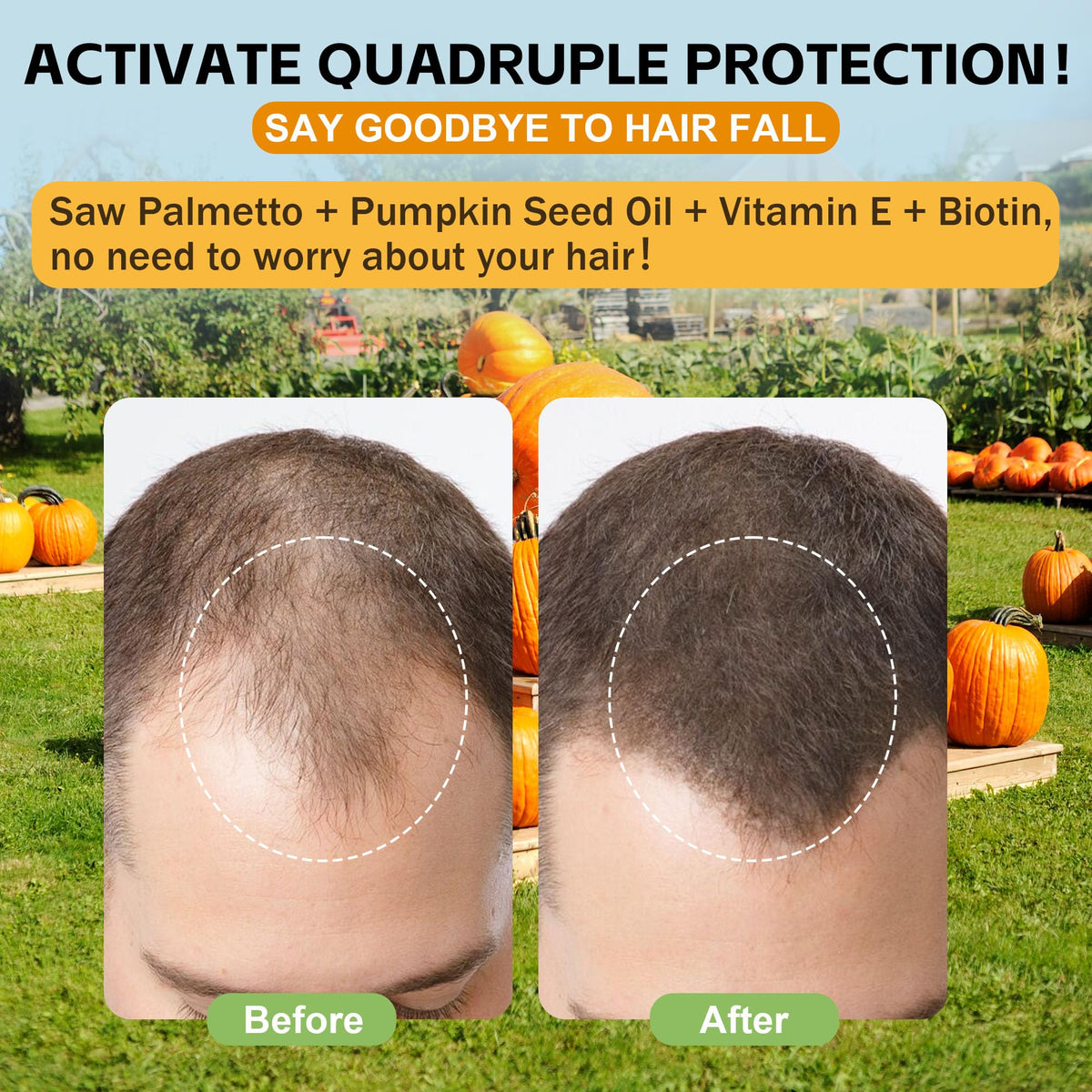 activate quadruple protection