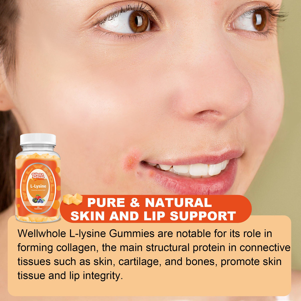 lysine supplement